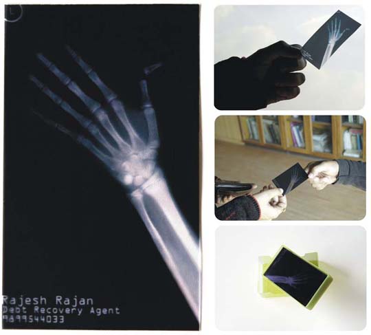 xray.jpg