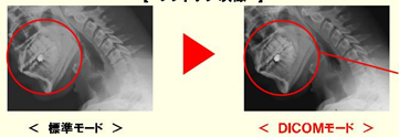 sanyo_dicom