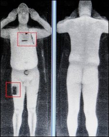 full-body-scan