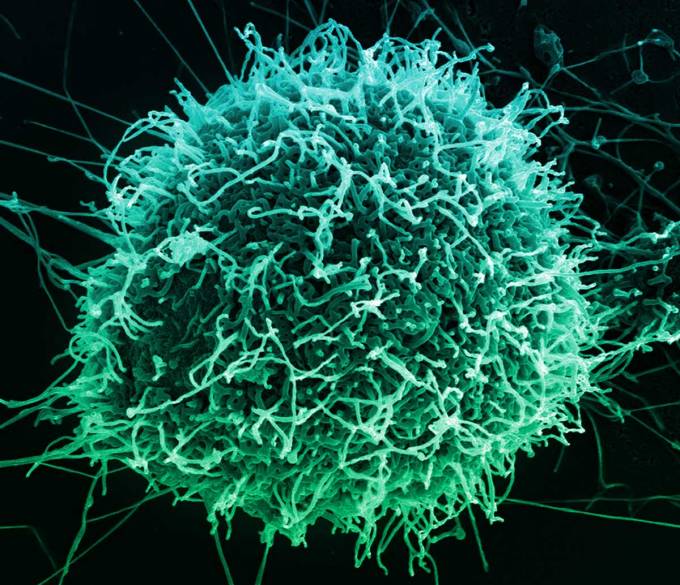 Ebola replicating on a cell. 