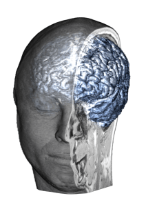 Brain_Cutout