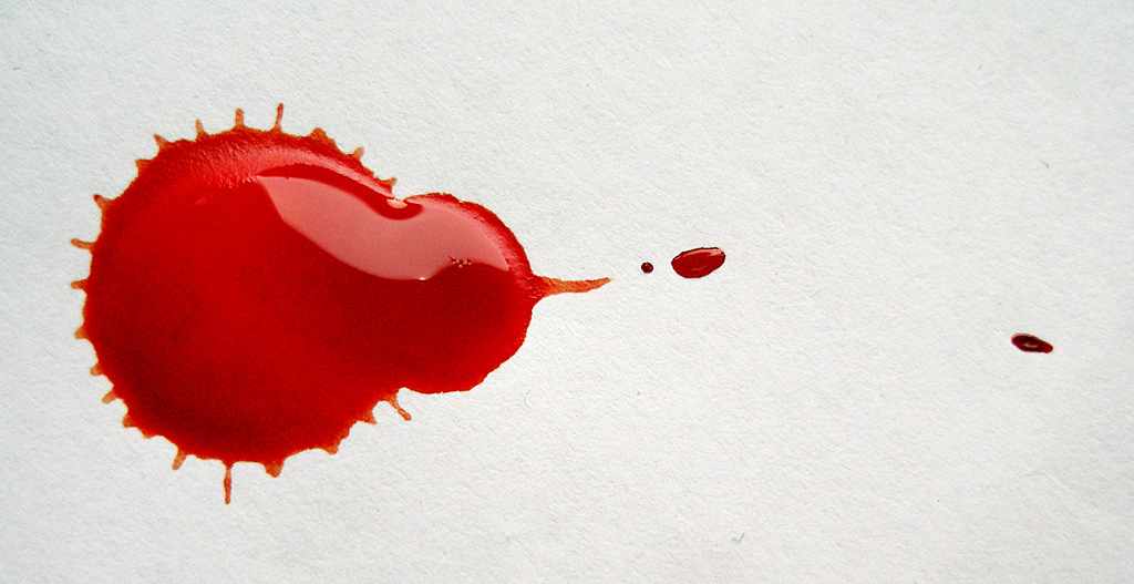large blood spatter