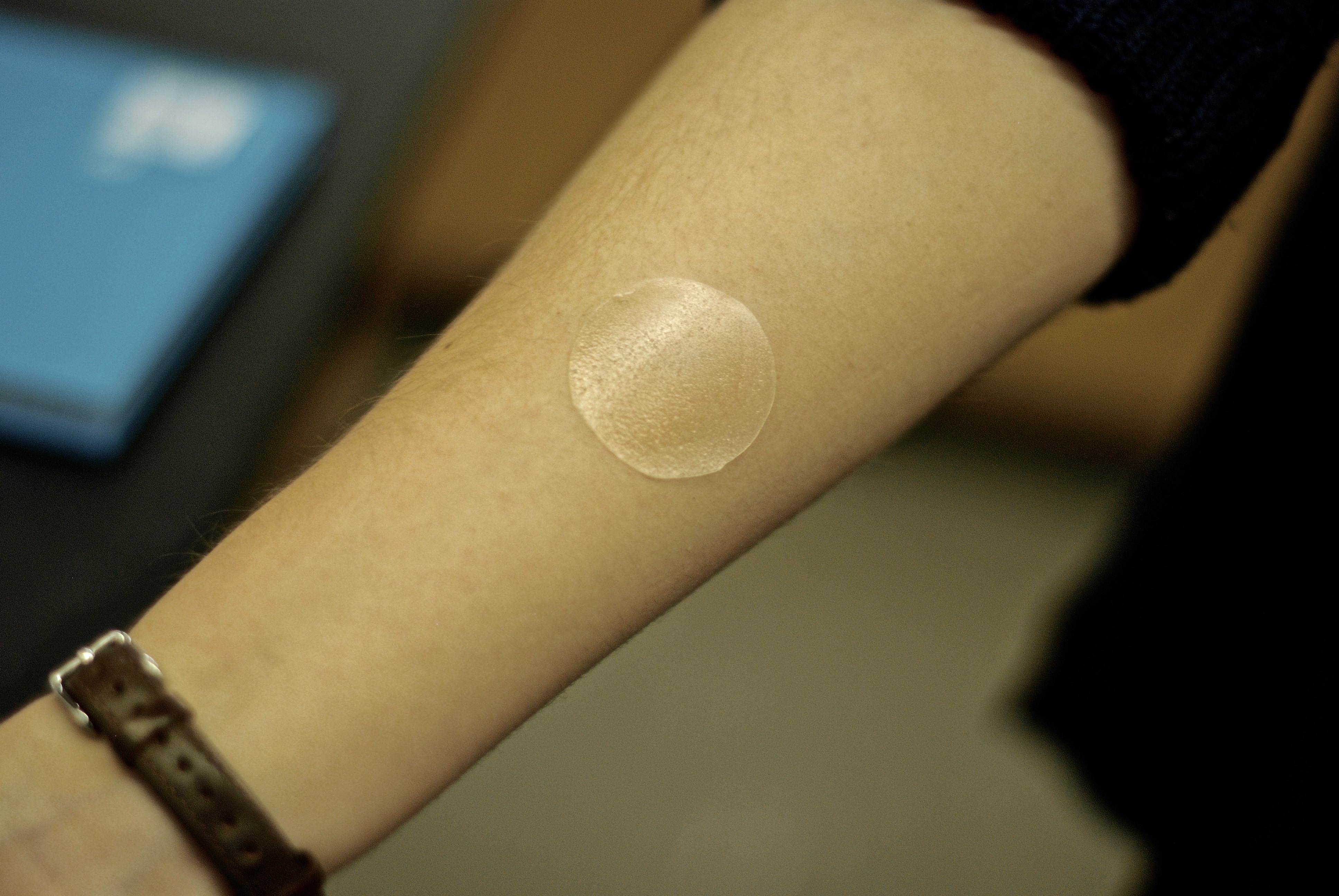 Avro Life Science - Drug Delivery Skin Patches 