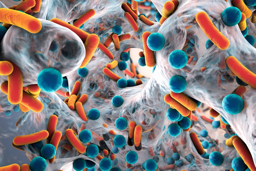 Biofilm of antibiotic resistant bacteria.