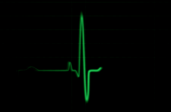 internet heartbeat