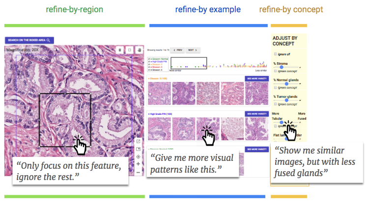 refinements