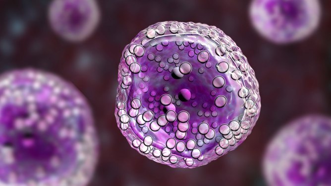 Burkitt's lymphoma cells. Computer illustration of malignant B-cell lymphocytes seen in Burkitt's lymphoma.