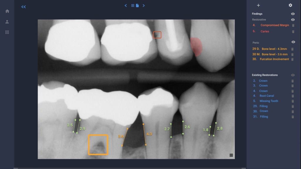 Overjet, dental care, oral care
