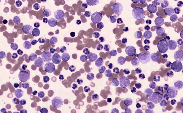 Blood cells viewed at a microscopic level