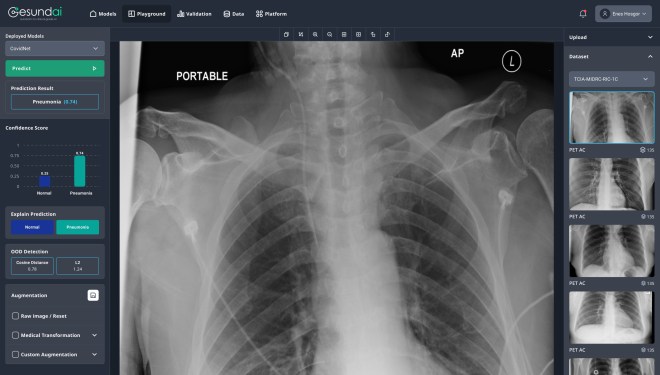 Gesund interface showing an xray of a ribcage and various readings.