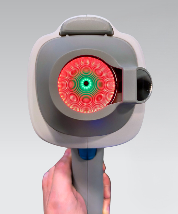 portable corneal topographer, K-Shape